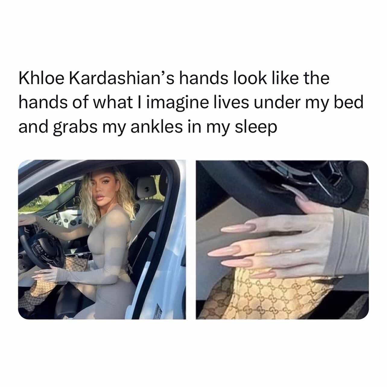 Khloe Kardashian's hands look like the hands of what I imagine lives under my bed and grabs my ankles in my sleep