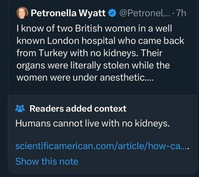 Fact Checker Memes I know of two British women in a well known London hospital who came back from Turkey with no kidneys. Their organs were literally stolen while the women were under anesthetic.... * Readers added context Humans cannot live with no kidneys.