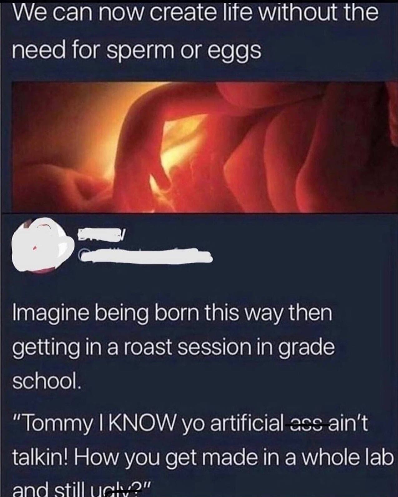 funny memes Imagine being born this way then getting in a roast session in grade school. "Tommy I KNOW yo artificial ass ain't talkin! How you