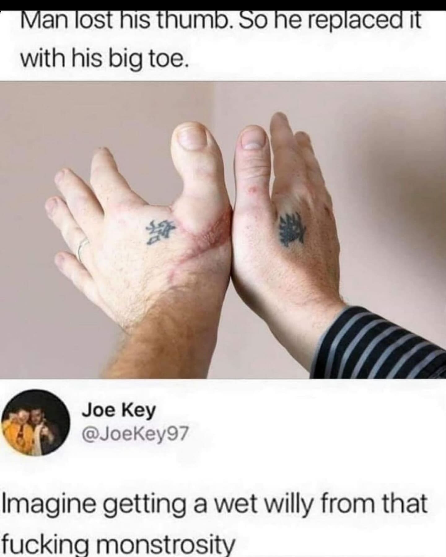 funny memes Man lost his thumb. So he replaced it with his big toe. Imagine getting a wet willy from that