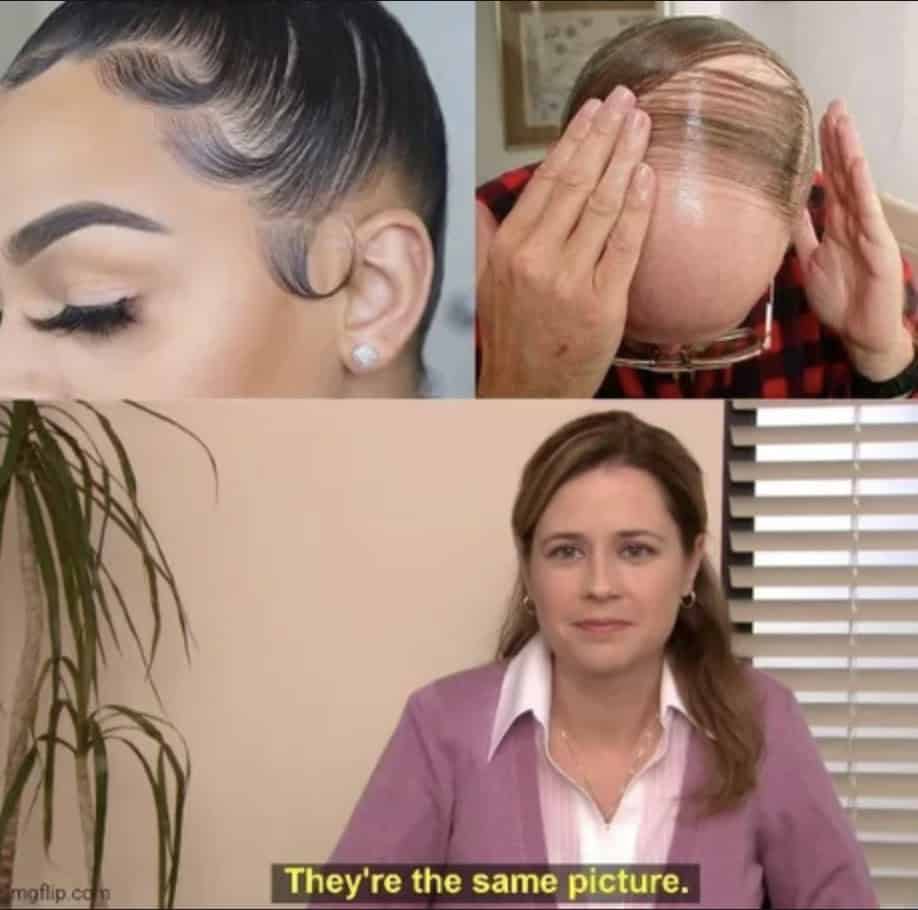 bald memes, bald guy memes, hair loss memes, funny bald jokes, bald humor, receding hairline humor, self-deprecating humor, bald life jokes