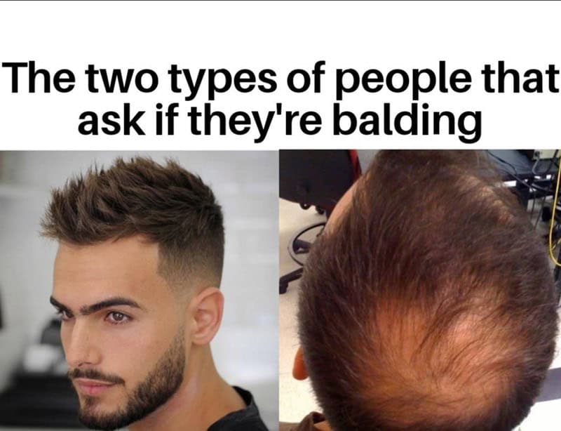 bald memes, bald guy memes, hair loss memes, funny bald jokes, bald humor, receding hairline humor, self-deprecating humor, bald life jokes