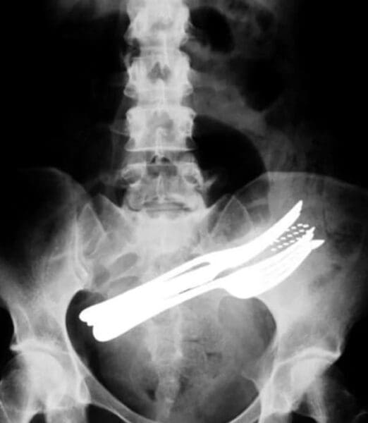 31 Weird X-Ray Photos That (Yes) They Really Are Real