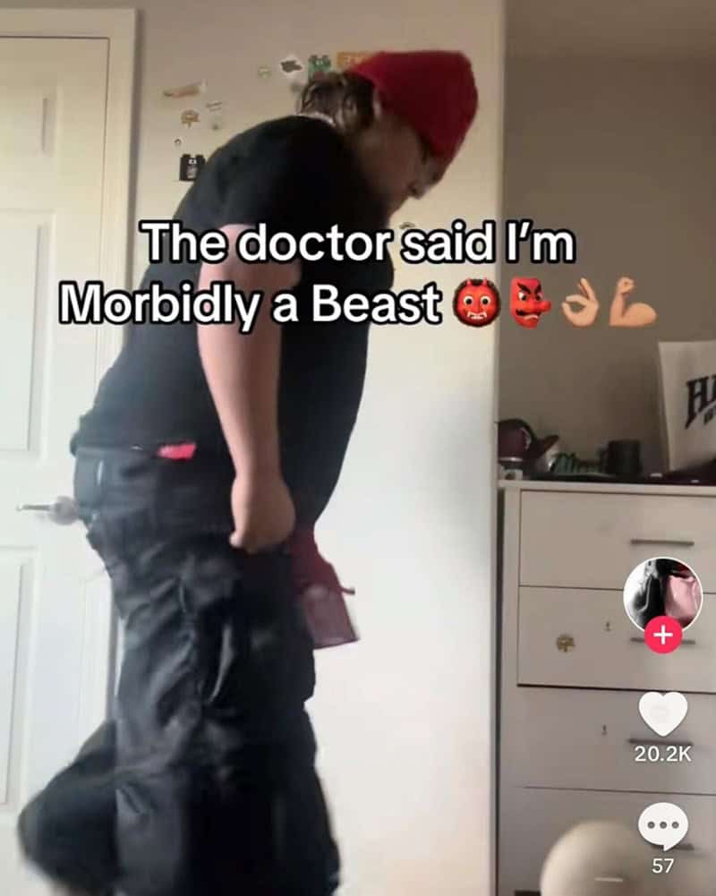 The doctor said I'm Morbidly a Beast