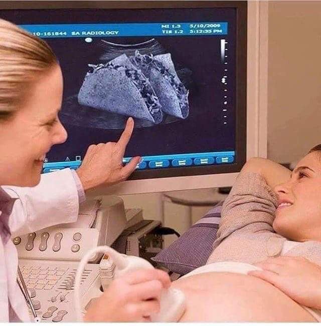taco sonogram