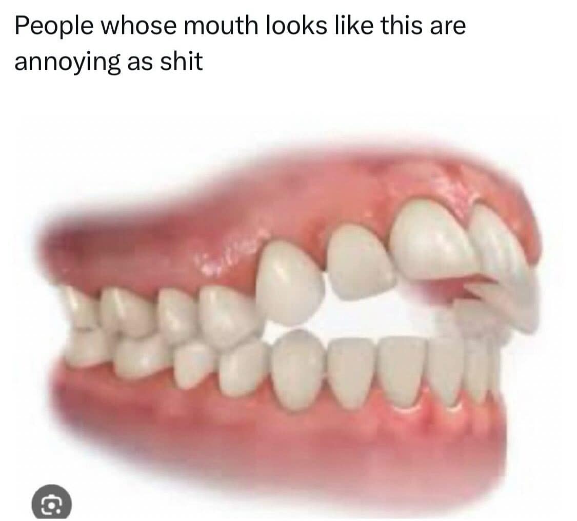 People whose mouth looks like this are annoying