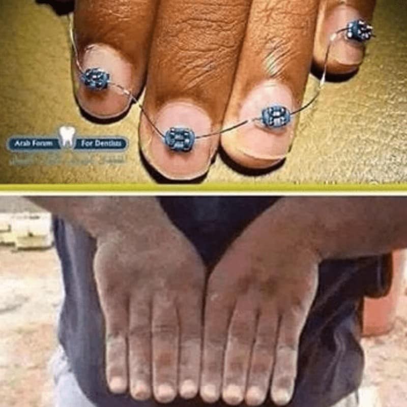 dentist meme, dentist memes, dental meme, tooth meme, dentist joke, dentist humor, oral care jokes, funny dentist, comedic dentist, dentist laughs, tooth jokes, molar humor, enamel gags