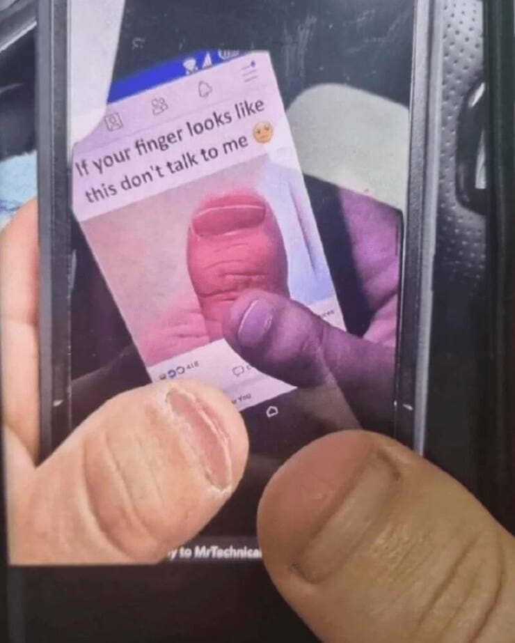 If your finger looks like this don't talk to me