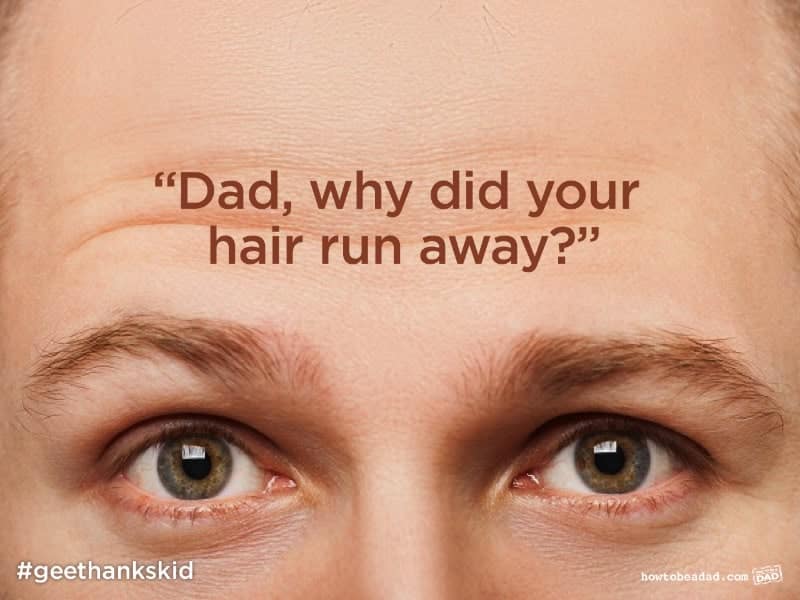 "Dad, why did your hair run away?"