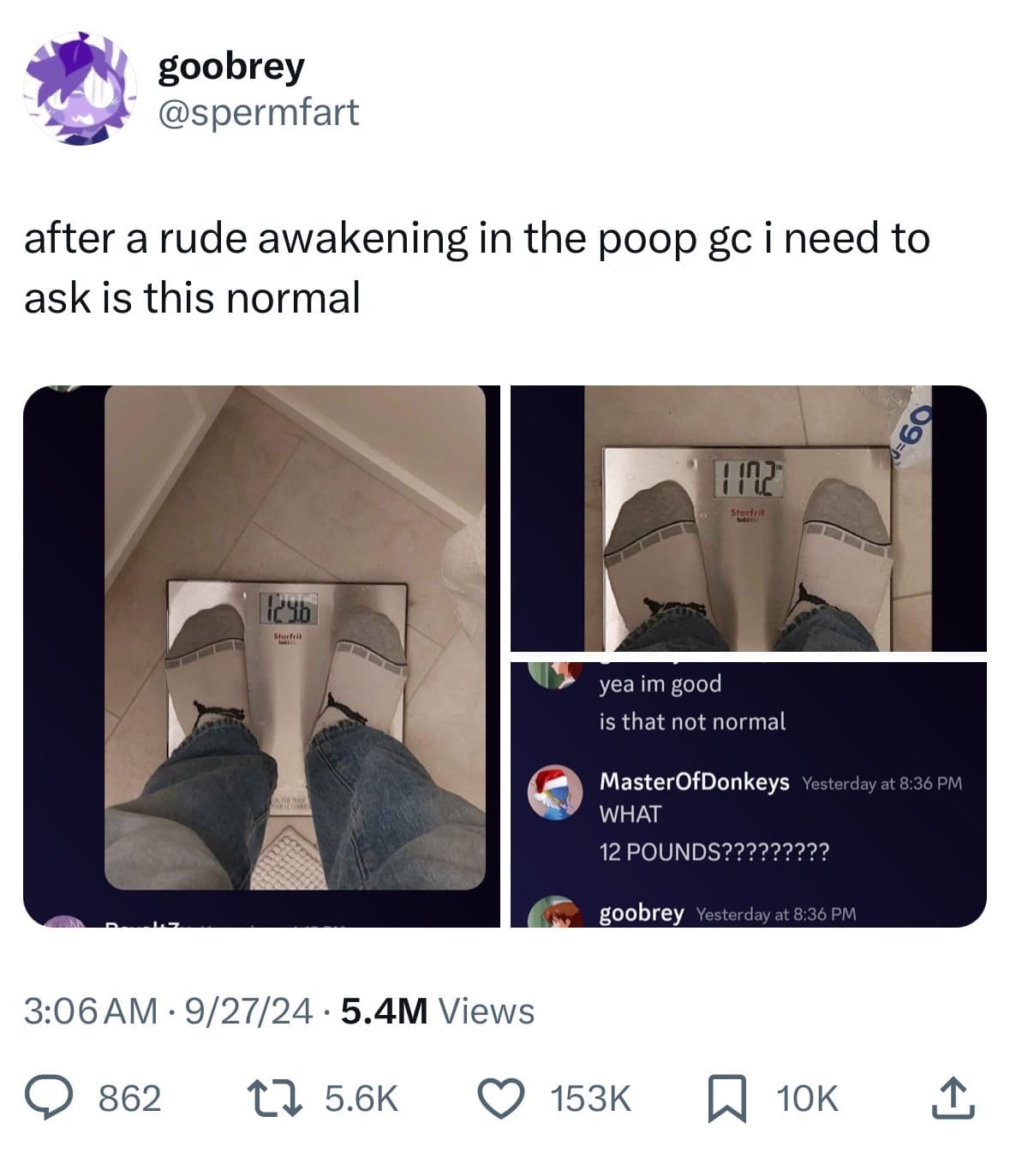 after a rude awakening in the poop gc i need to ask is this normal