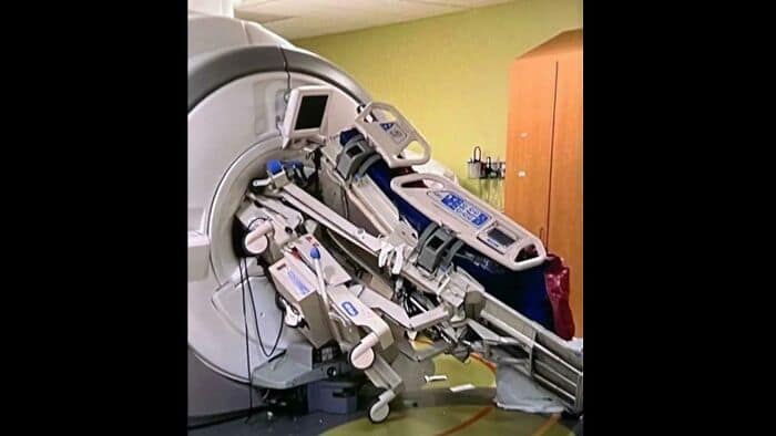 A metal hospital gurney sucked into and mangled by a powerful MRI machine.