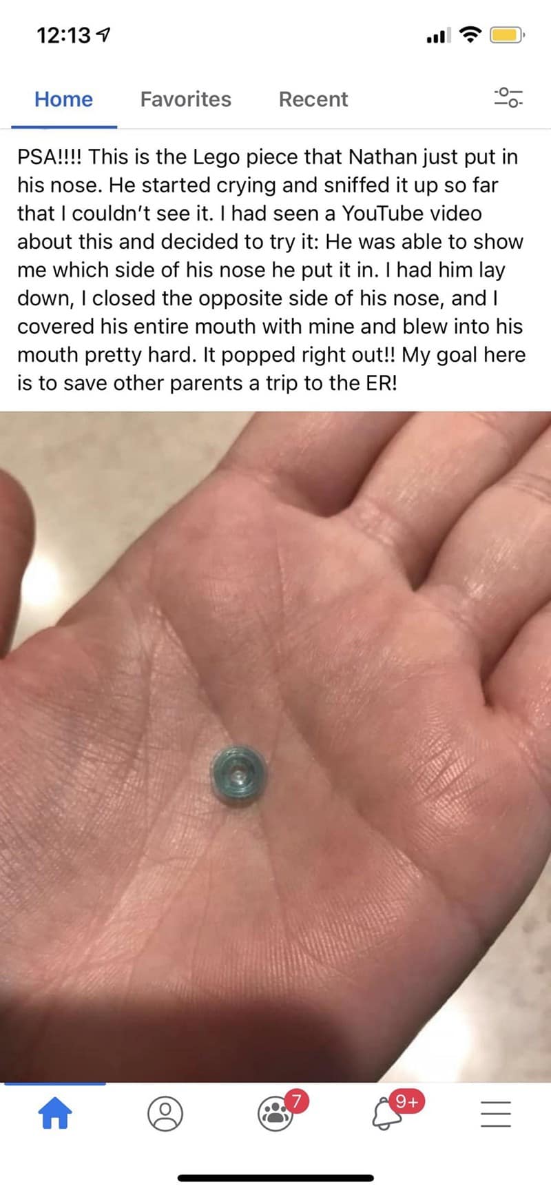 Facebook post showing Lego piece removed from child’s nose using mouth-blow technique