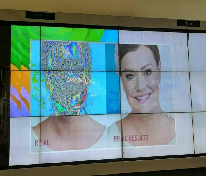 One of the worst ads, a glitched digital screen shows a psychedelic face as the "before" picture.