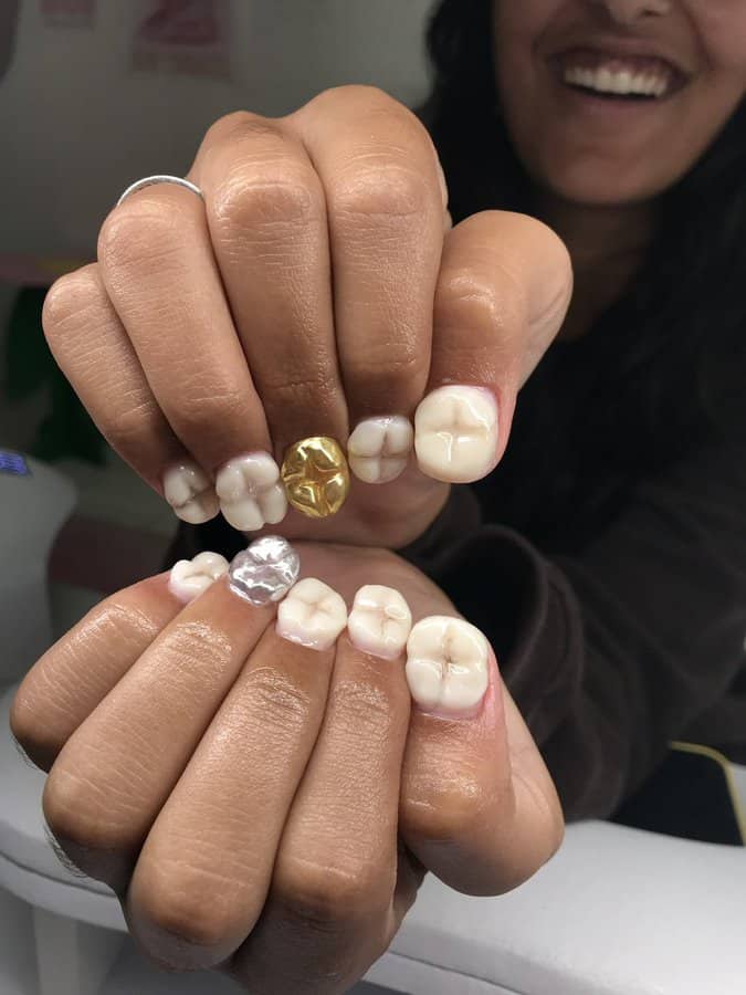 A deeply cursed image of a manicure where the nails are designed to look like a full set of human teeth.