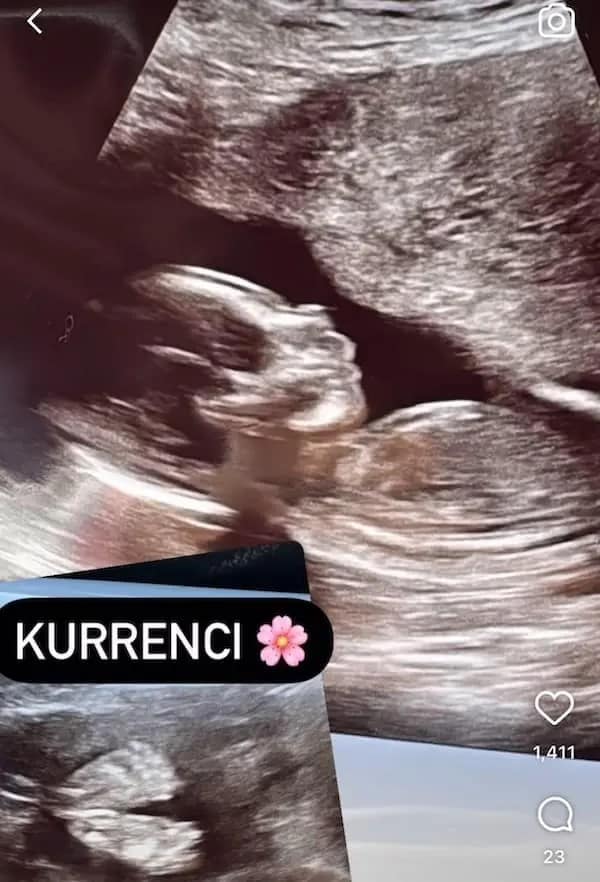 A baby ultrasound photo with the uniquely spelled and bad name "Kurrenci" (Currency) written on it.
