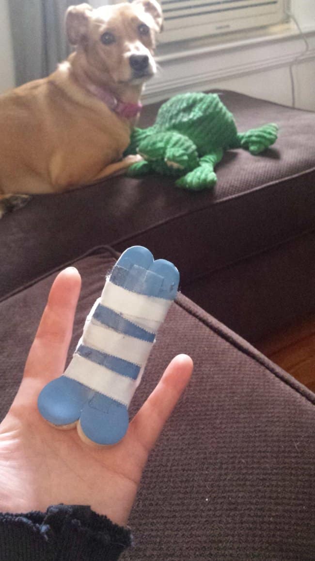 A person holding up their two fingers in a blue splint that looks hilariously phallic.