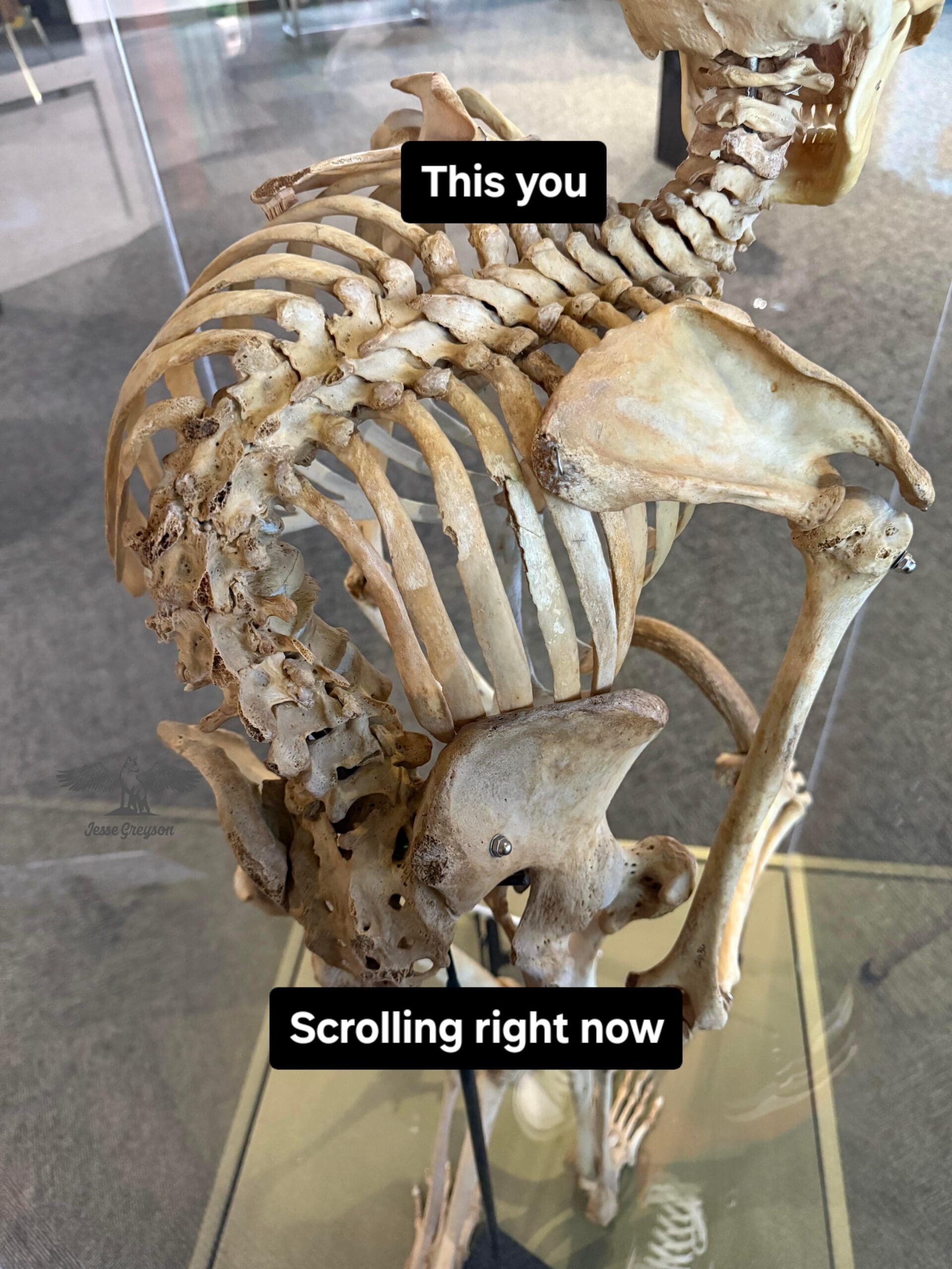 A funny pic of a skeleton with extremely bad, curved posture, captioned "This you Scrolling right now."