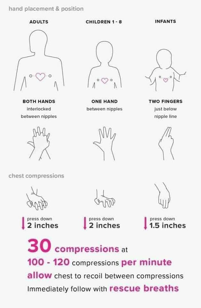 Medical diagram demonstrating CPR hand placement and compression depth for different ages.