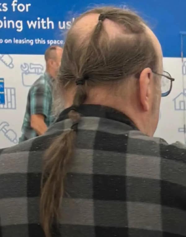 The back of a balding man's head, showing a few thin strands of hair tied into a long, wispy ponytail.