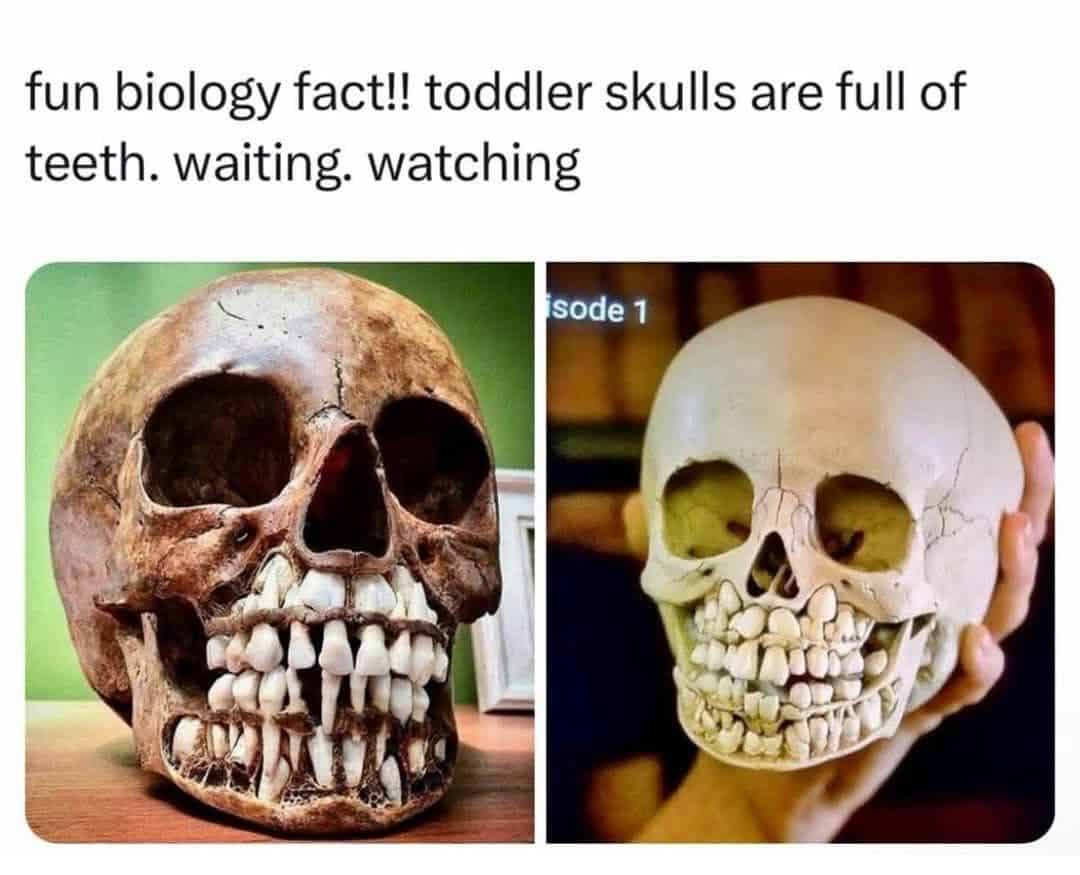 Comparison of two toddler skulls revealing rows of adult teeth waiting and watching inside the jaw.