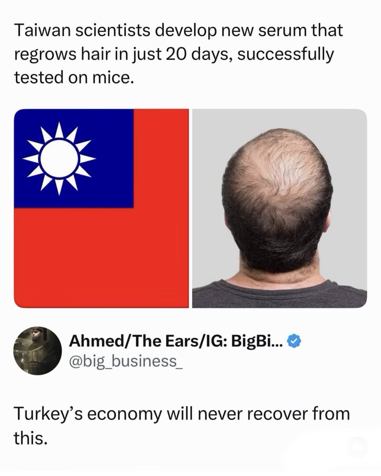News headline about hair regrowth serum in Taiwan with a joke about the Turkish hair economy.