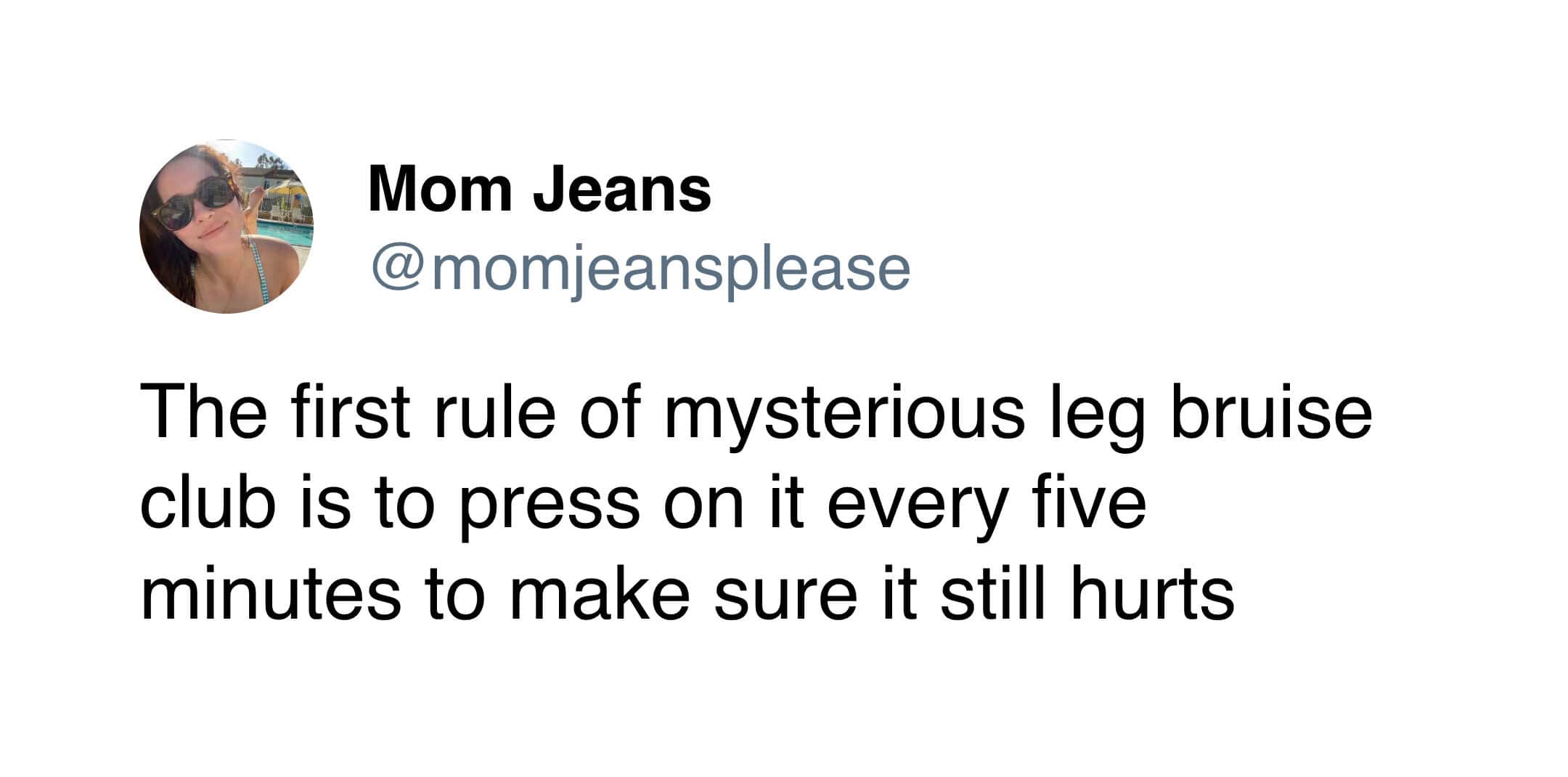 A funny tweet from Mom Jeans establishing the first rule of the "mysterious leg bruise club": constantly pressing it to confirm the pain.