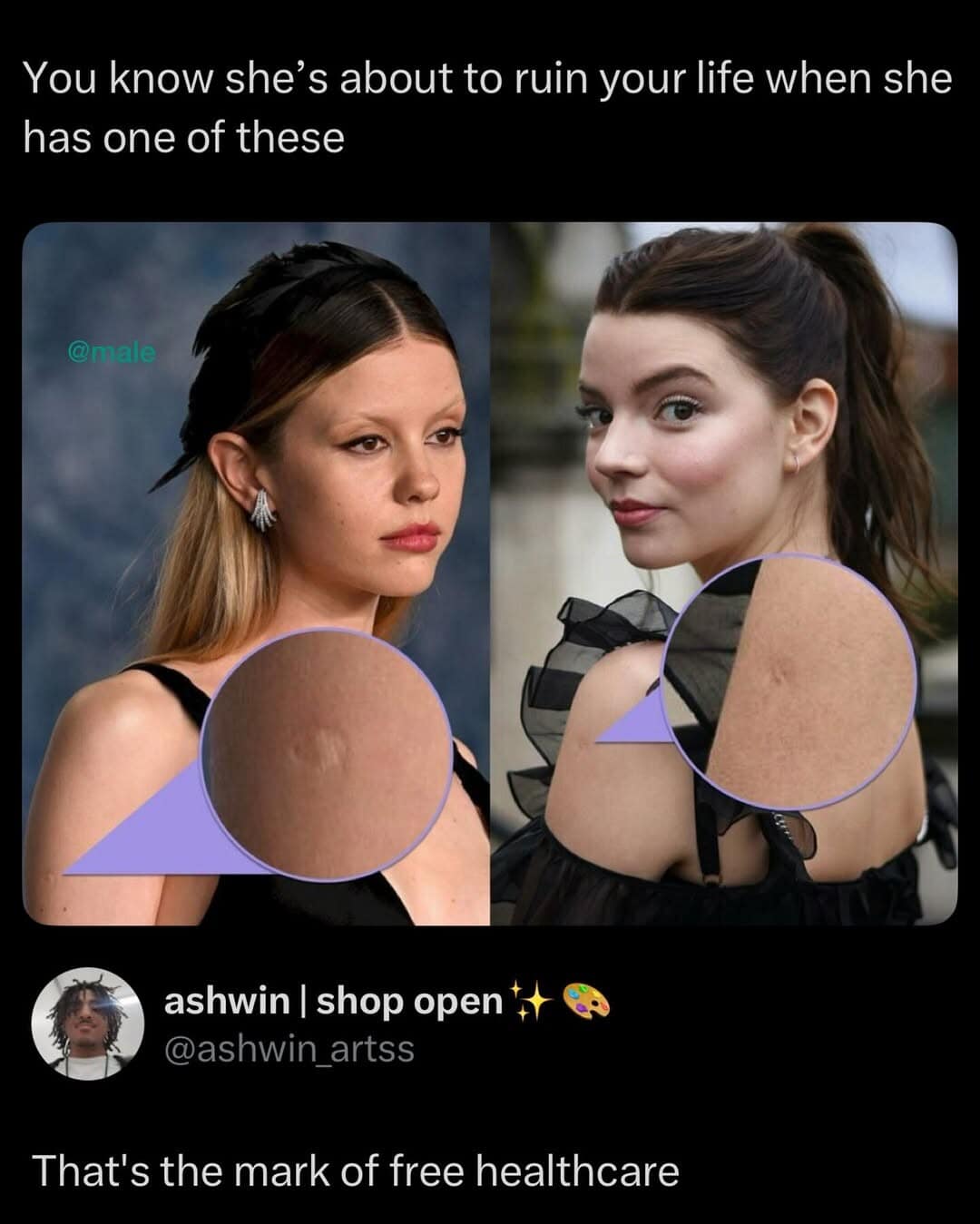 A meme dump comparison of actresses Mia Goth and Anya Taylor-Joy, joking that the small circular scars on their arms are the universal "mark of free healthcare."
