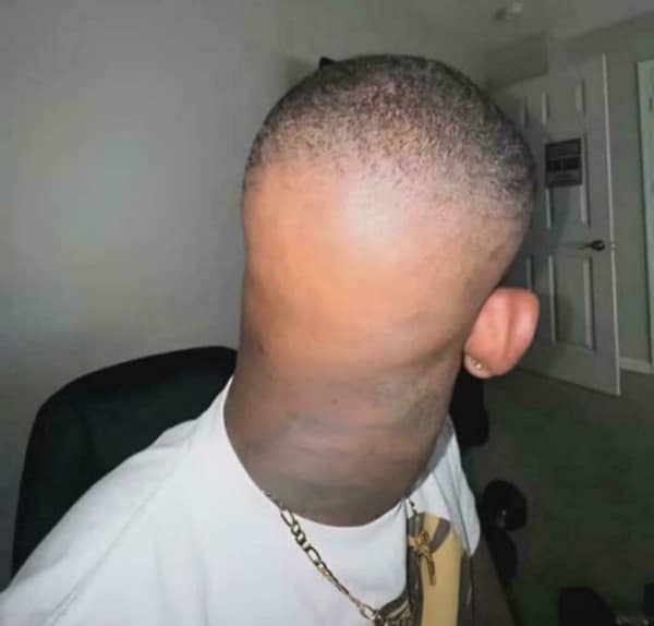 tragically botched bad haircut showing the back of a man's head where the barber completely shaved the entire lower half of his skull smooth, leaving a bizarre, floating patch of stubble near the crown.