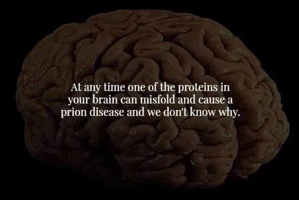A detailed anatomical image of a human brain on a black background is paired with a medical spooky fact about how a single misfolded protein can cause a fatal prion disease at any time.