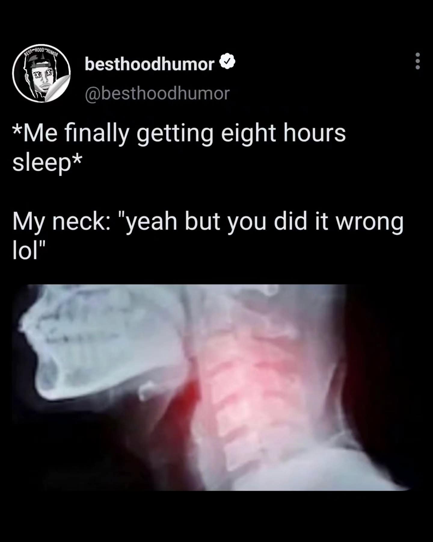 painful health meme dump entry about the betrayal of sleep. The text describes waking up after a full eight hours only for an X-ray of a glowing, pained neck to reply: "yeah but you did it wrong lol."