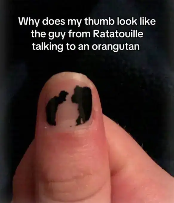 A hilarious and hyper-specific unhinged screenshot of someone's thumb with chipped black nail polish. The remaining polish forms two silhouettes that the user claims look exactly like "the guy from Ratatouille talking to an orangutan."